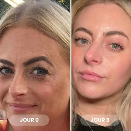 Masque Bio-Collagène Réduit les rides de 75 % après 1 seule application